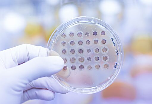 Gloved hand holding an agar plate with bacterial colonies